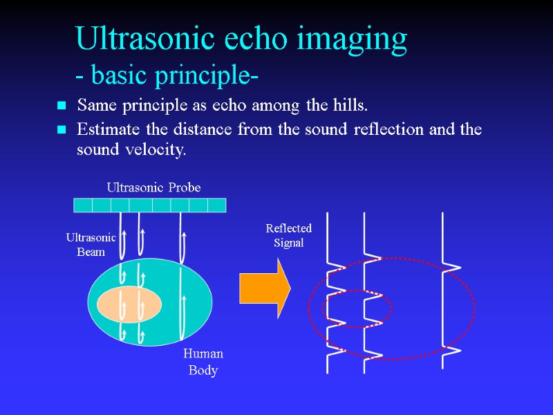 Ultrasonic echo imaging - basic principle- Same principle as echo among the hills. Estimate
